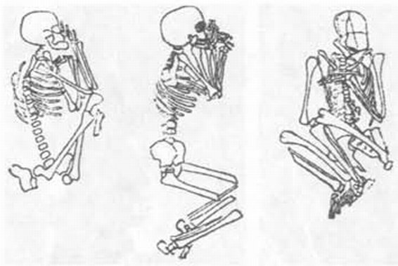 Погребения в «утробном» положении, открытые в некрополе на Северном берегу Херсонеса (по Г.Д. Белову) Погребения в «утробном» положении, открытые в некрополе на Северном берегу Херсонеса (по Г.Д. Белову)